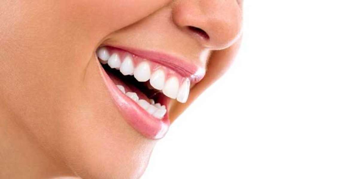 Teeth Whitening in the Virgin Islands | VI Dental Center