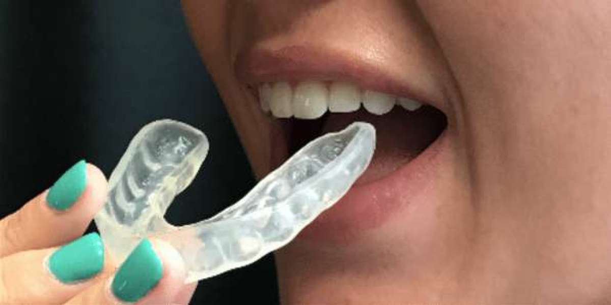 How Mouthguards Prevent Dental Injuries: A Detailed Explanation