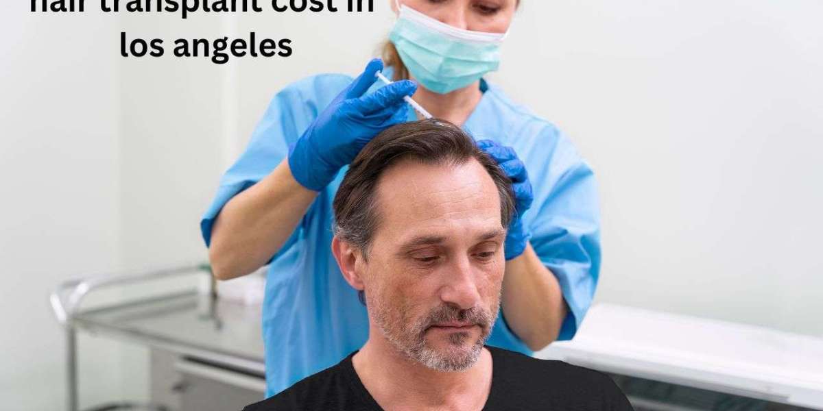 Unveiling the Process of Hair Transplant in Los Angeles.