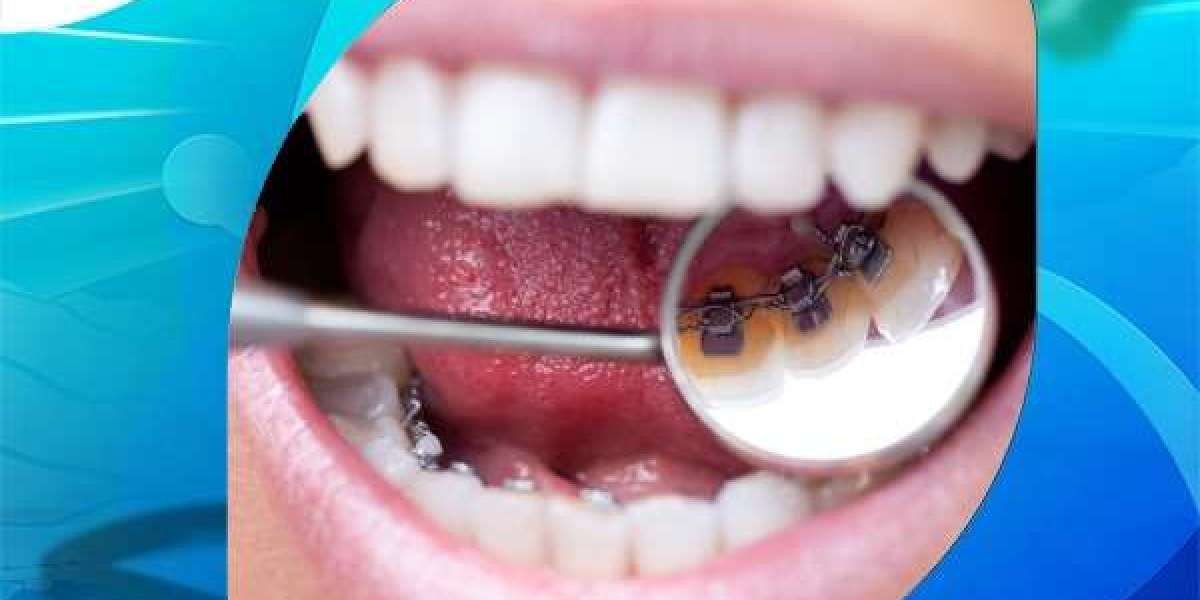 اهمية تقويم الأسنان بعد سن الأربعين