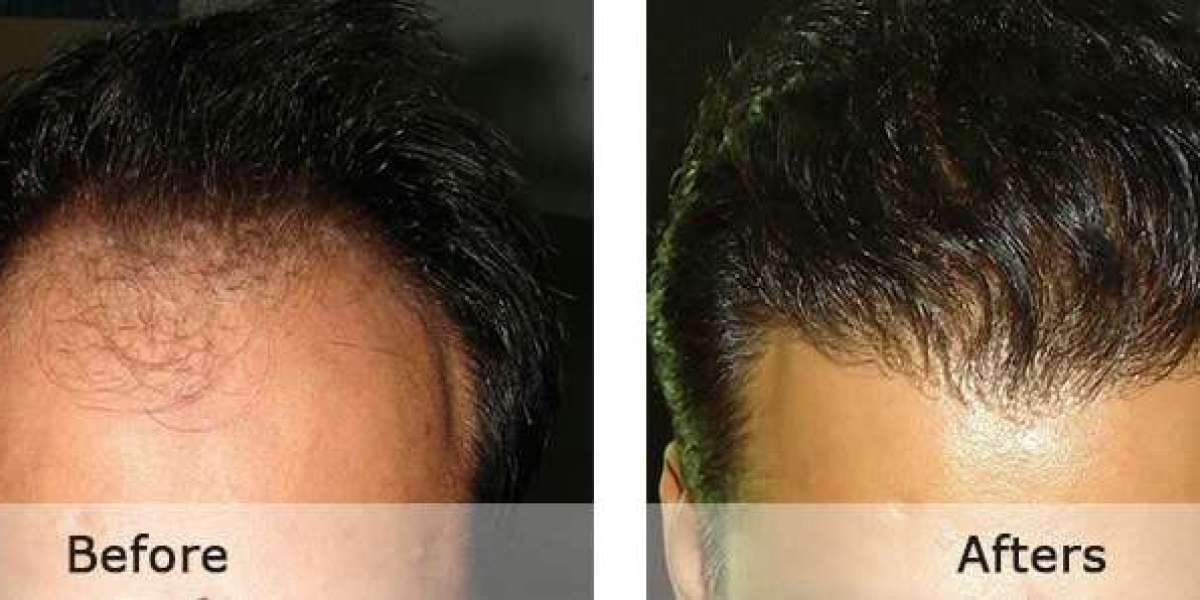 Doctor Hair Fall Solution Pakistan