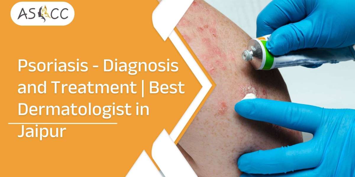 Psoriasis - Diagnosis and Treatment | Best Dermatologist in Jaipur