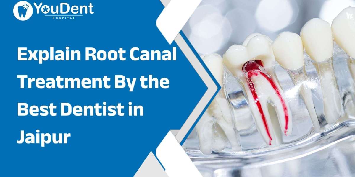 Explain Root Canal Treatment By the Best Dentist in Jaipur