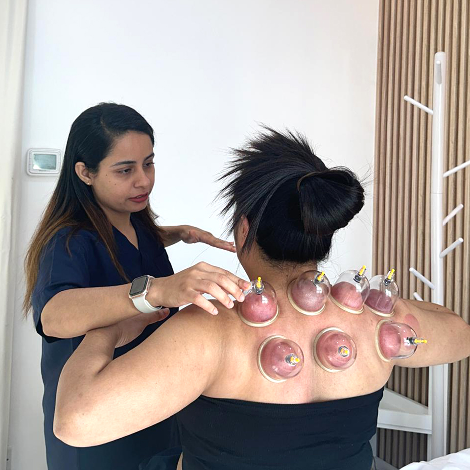 Cupping and Moxibustion Therapy in Dubai | Hijama in Dubai