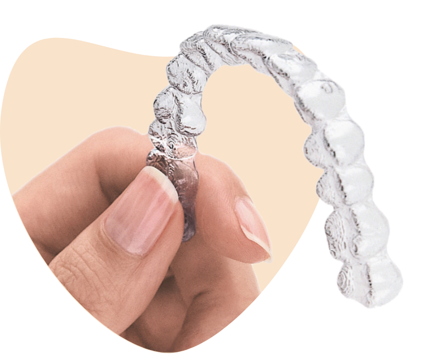 Aligners Price in Lahore