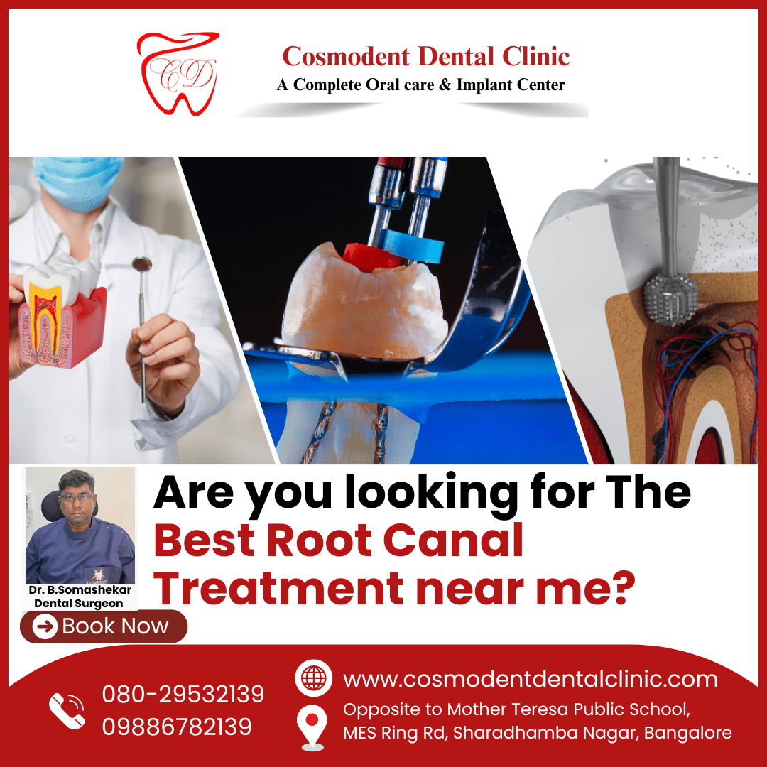 Root Canal Treatment: A Painless Solution for Dental Health