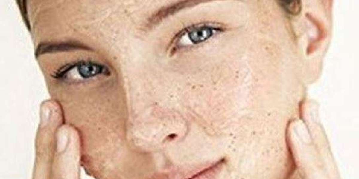 Salicylic Acid Face Wash: The Ultimate Solution for Clear, Acne-Free Skin in 2025