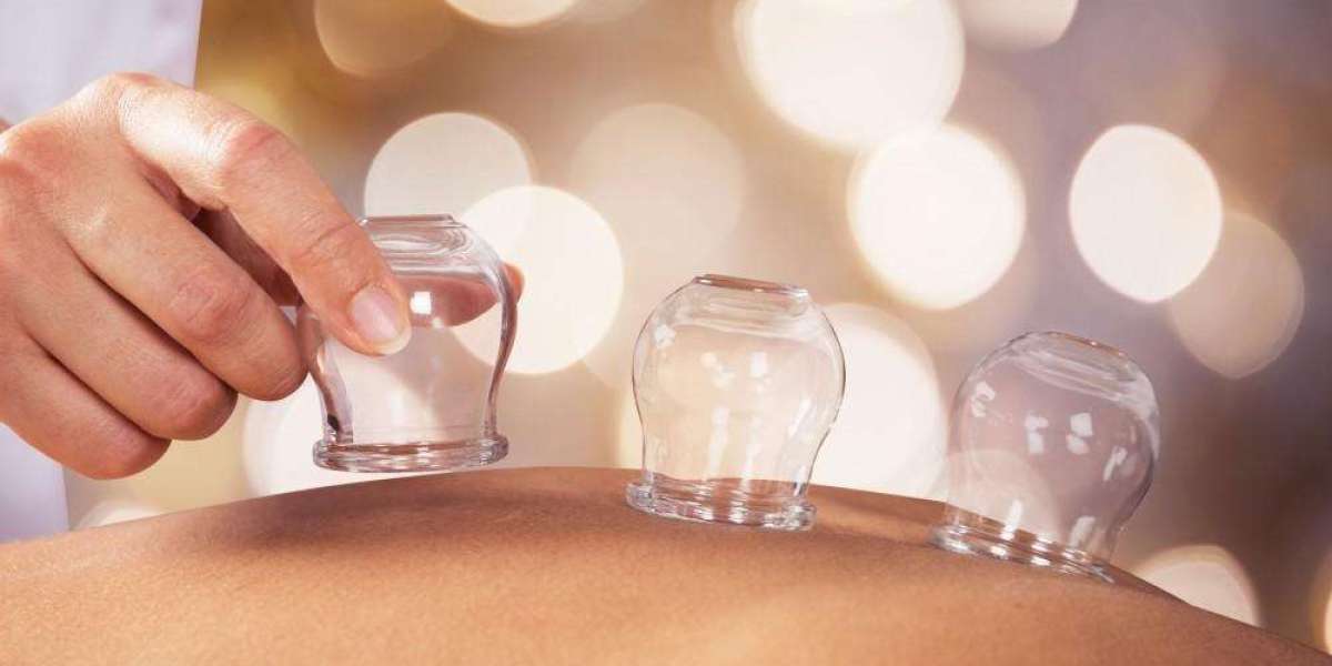 Cupping Therapy NYC